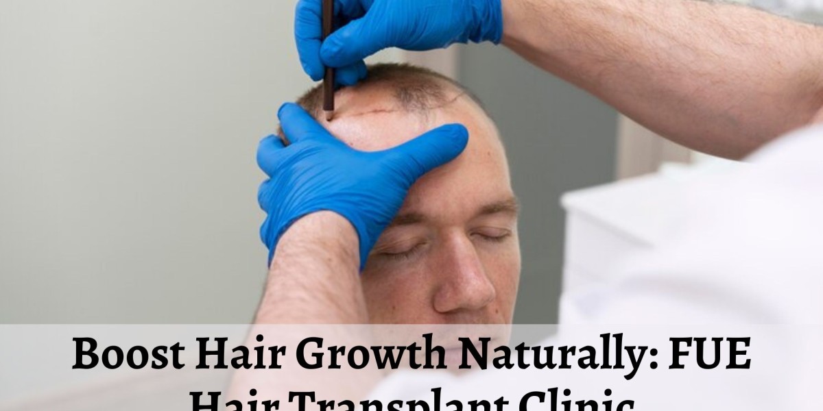 Boost Hair Growth Naturally: FUE Hair Transplant Clinic