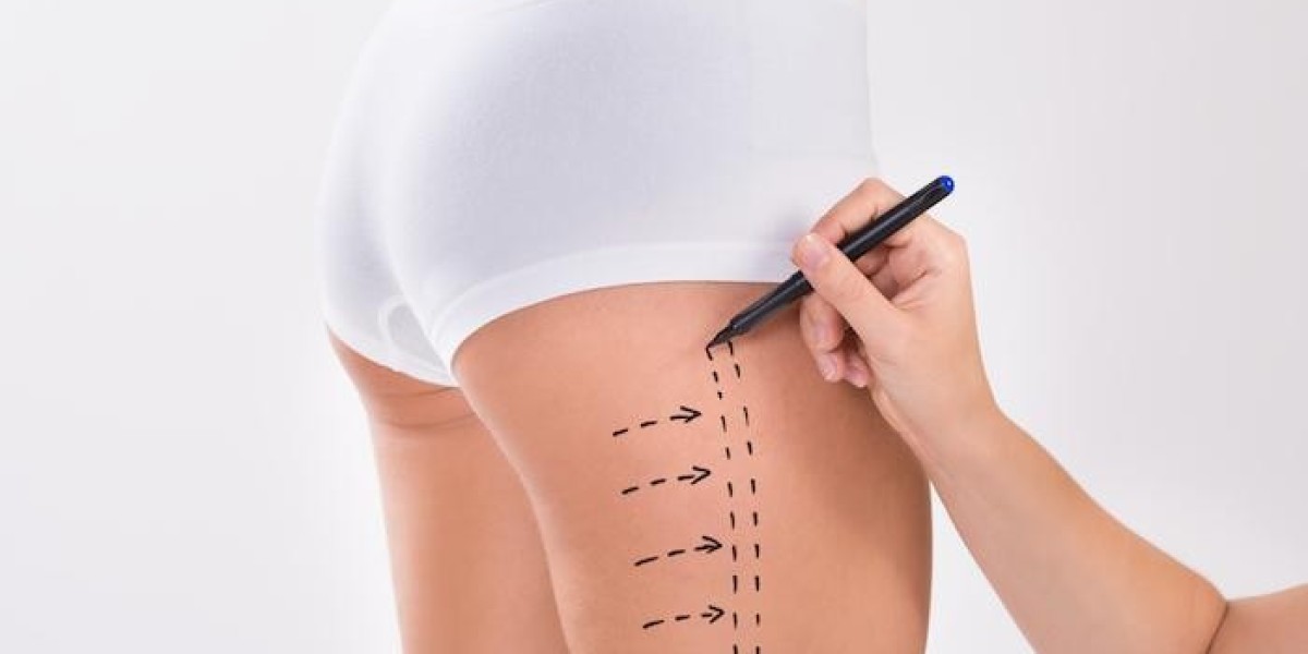 Finding Confidence Through Liposuction Surgery